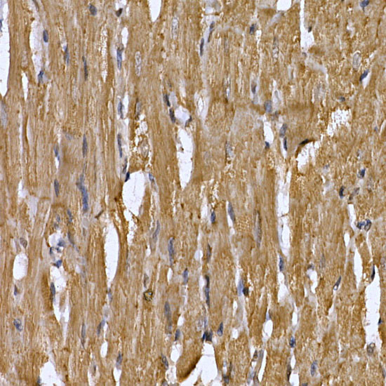 STAT3 Antibody in Immunohistochemistry (Paraffin) (IHC (P))