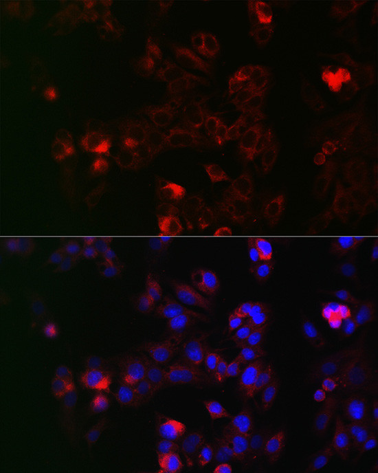 NOX1 Antibody in Immunocytochemistry (ICC/IF)