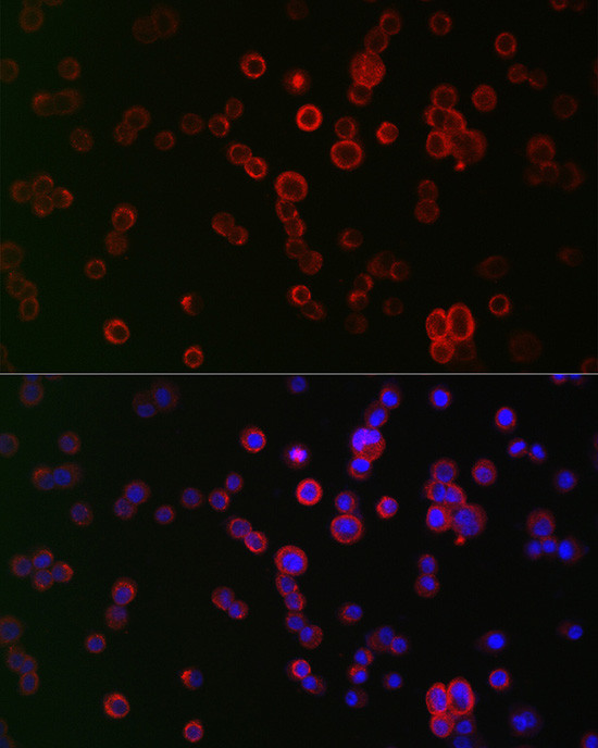 NOX1 Antibody in Immunocytochemistry (ICC/IF)