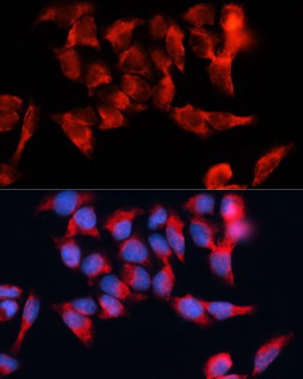 BST-2 Antibody in Immunocytochemistry (ICC/IF)