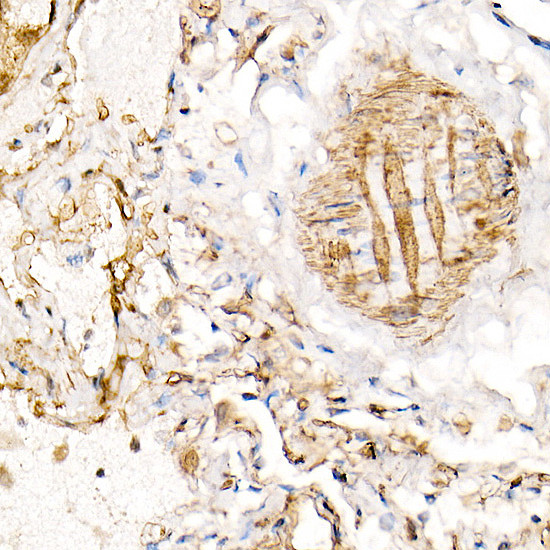 BST-2 Antibody in Immunohistochemistry (Paraffin) (IHC (P))