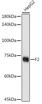 Prothrombin Antibody in Western Blot (WB)