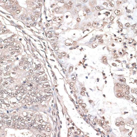 MEF2C Antibody in Immunohistochemistry (Paraffin) (IHC (P))