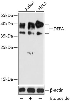 ICAD Antibody in Western Blot (WB)