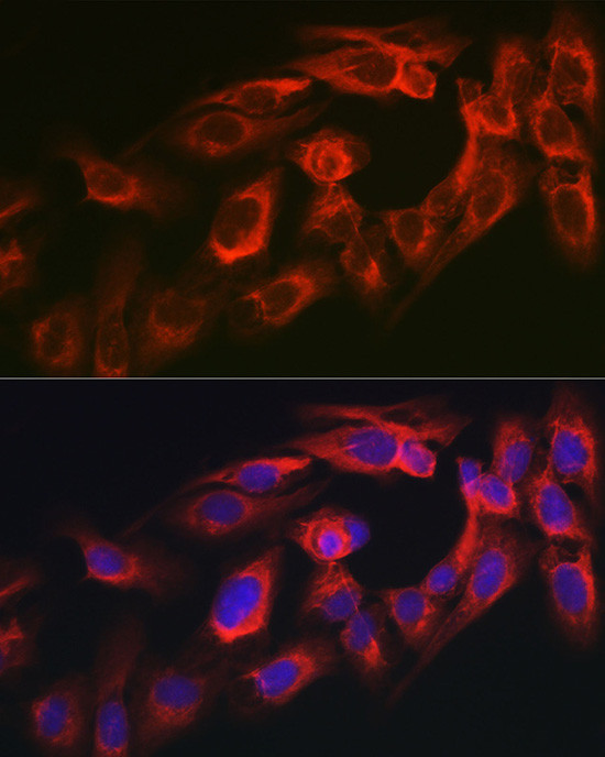 MYO10 Antibody in Immunocytochemistry (ICC/IF)