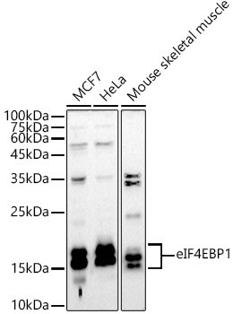 4EBP1 Antibody in Western Blot (WB)