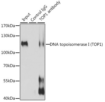 TOP1 Antibody in Immunoprecipitation (IP)