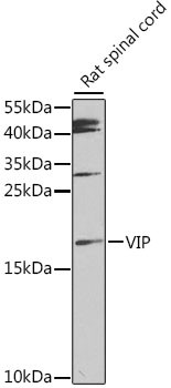 VIP Antibody in Western Blot (WB)