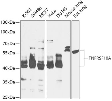 DR4 Antibody in Western Blot (WB)