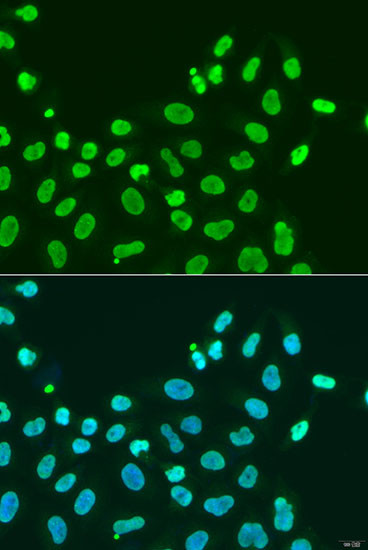 HP1 alpha Antibody in Immunocytochemistry (ICC/IF)