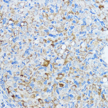 Aromatase Antibody in Immunohistochemistry (Paraffin) (IHC (P))