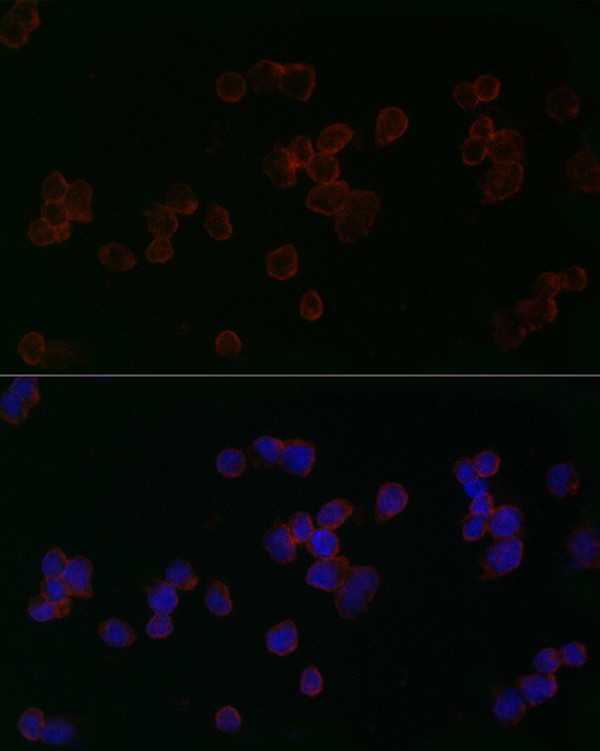 MFN2 Antibody in Immunocytochemistry (ICC/IF)