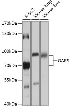 GARS Antibody in Western Blot (WB)