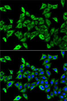 HADHA Antibody in Immunocytochemistry (ICC/IF)