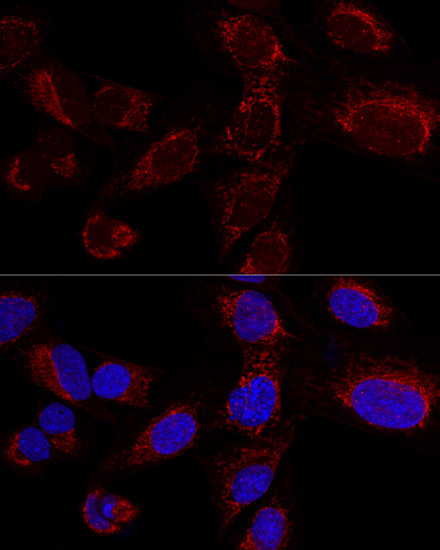 HADHA Antibody in Immunocytochemistry (ICC/IF)