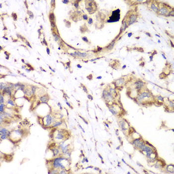 HADHA Antibody in Immunohistochemistry (Paraffin) (IHC (P))