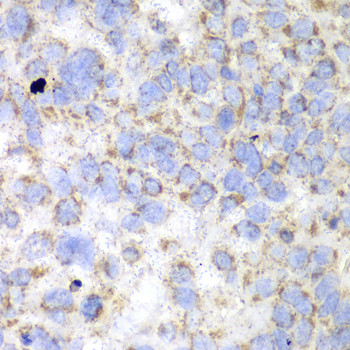 HADHA Antibody in Immunohistochemistry (Paraffin) (IHC (P))