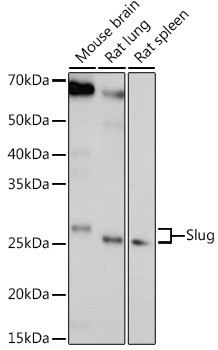 SLUG Antibody in Western Blot (WB)