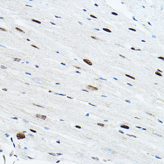 TEF1 Antibody in Immunohistochemistry (Paraffin) (IHC (P))