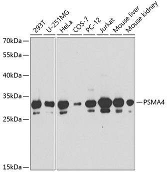 PSMA4 Antibody in Western Blot (WB)