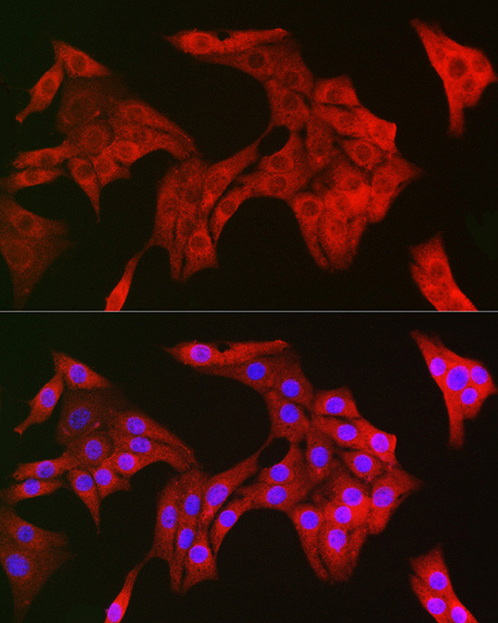 TRIM21 Antibody in Immunocytochemistry (ICC/IF)