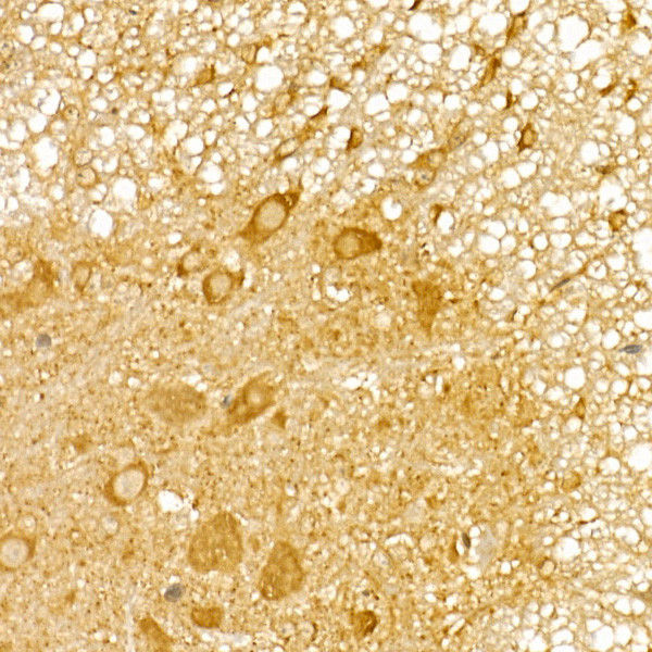 TRIM21 Antibody in Immunohistochemistry (Paraffin) (IHC (P))