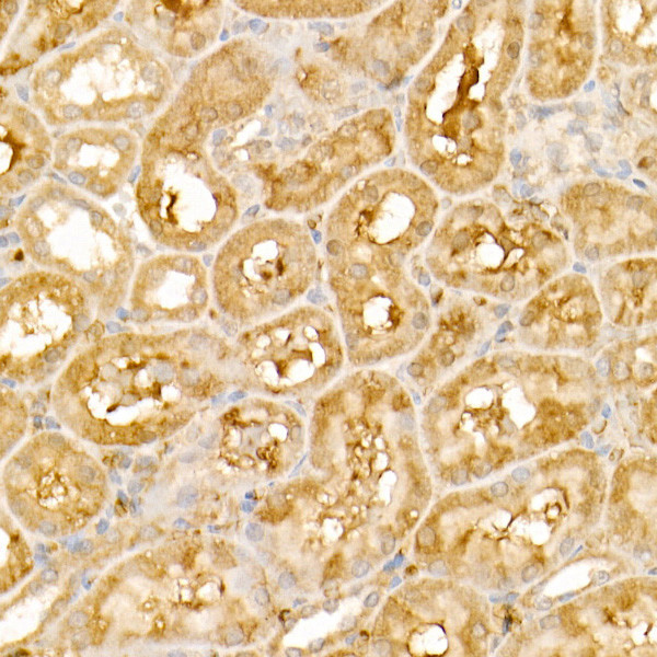 TRIM21 Antibody in Immunohistochemistry (Paraffin) (IHC (P))