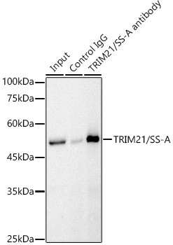 TRIM21 Antibody in Immunoprecipitation (IP)