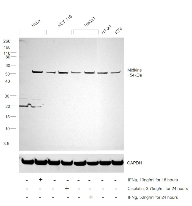 TRIM21 Antibody in Western Blot (WB)