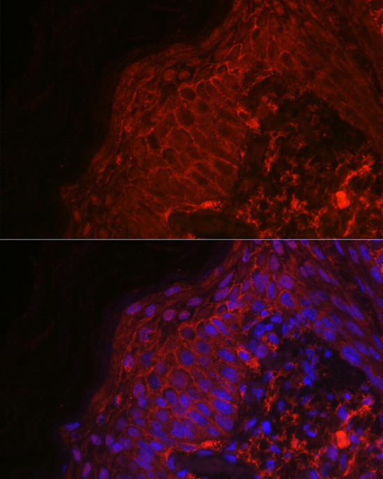 EGF Antibody in Immunohistochemistry (Paraffin) (IHC (P))