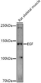 EGF Antibody in Western Blot (WB)