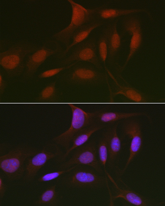 p130 Antibody in Immunocytochemistry (ICC/IF)