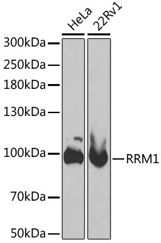 RRM1 Antibody in Western Blot (WB)