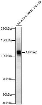 ATP1A2 Antibody in Western Blot (WB)