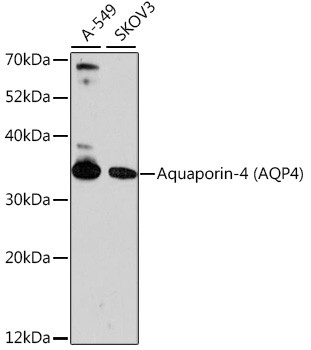 Aquaporin 4 Antibody in Western Blot (WB)