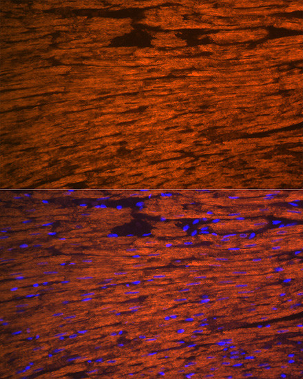 MYL2 Antibody in Immunohistochemistry (Paraffin) (IHC (P))