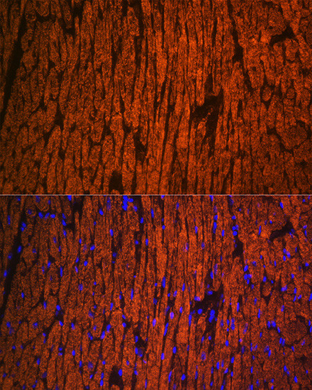 MYL2 Antibody in Immunohistochemistry (Paraffin) (IHC (P))