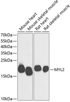 MYL2 Antibody in Western Blot (WB)