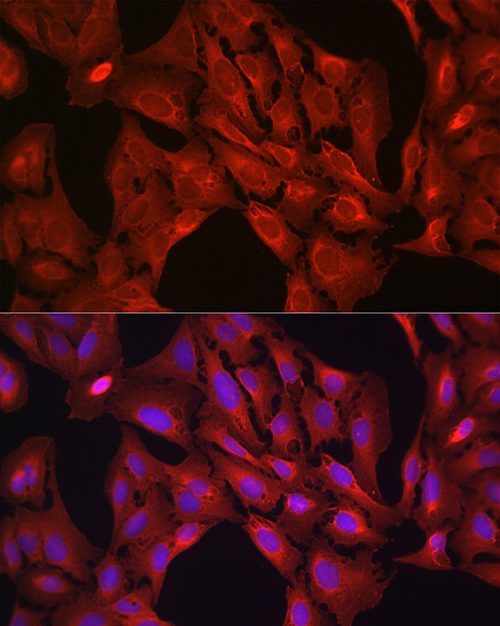 VASP Antibody in Immunocytochemistry (ICC/IF)