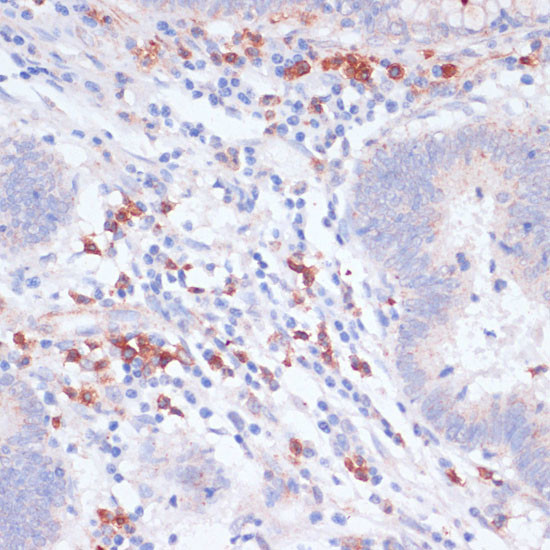 VASP Antibody in Immunohistochemistry (Paraffin) (IHC (P))