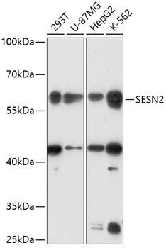 SESN2 Antibody in Western Blot (WB)