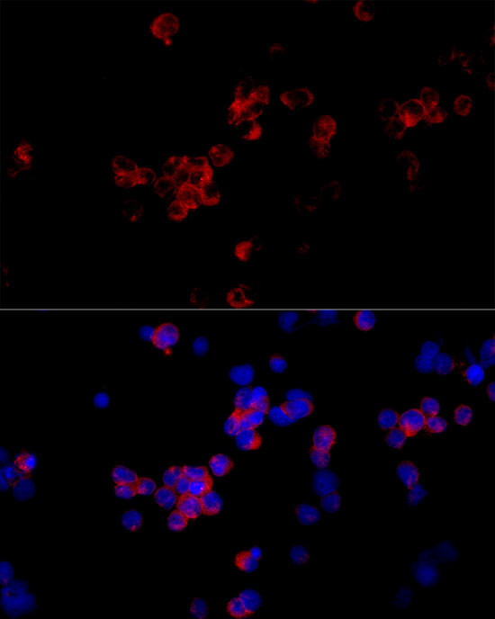 CD299 (DC-SIGN/L) Antibody in Immunocytochemistry (ICC/IF)