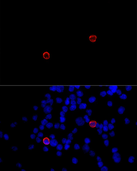 CD299 (DC-SIGN/L) Antibody in Immunocytochemistry (ICC/IF)