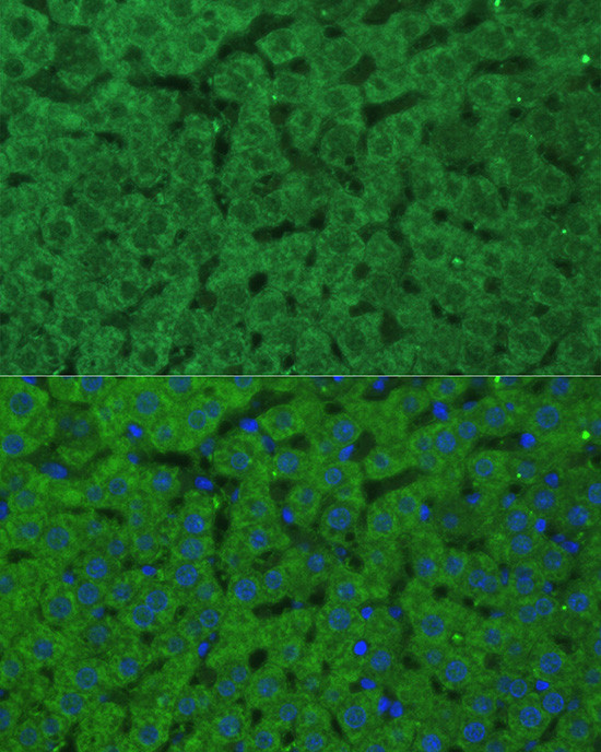 CBS Antibody in Immunohistochemistry (Paraffin) (IHC (P))