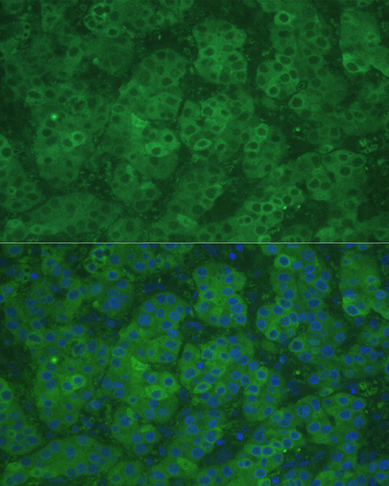 CBS Antibody in Immunohistochemistry (Paraffin) (IHC (P))