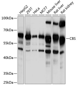 CBS Antibody in Western Blot (WB)