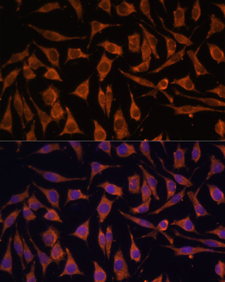 NDUFA4L2 Antibody in Immunocytochemistry (ICC/IF)