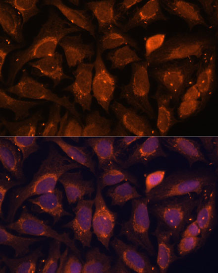 NDUFA4L2 Antibody in Immunocytochemistry (ICC/IF)