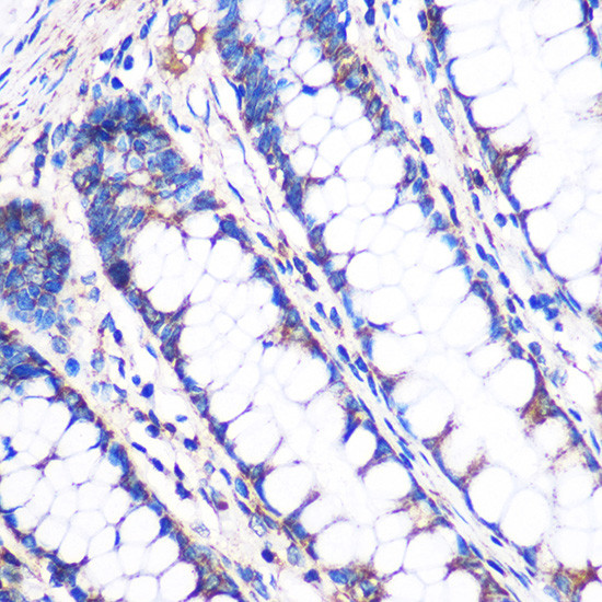 NDUFA4L2 Antibody in Immunohistochemistry (Paraffin) (IHC (P))