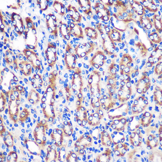 NDUFA4L2 Antibody in Immunohistochemistry (Paraffin) (IHC (P))